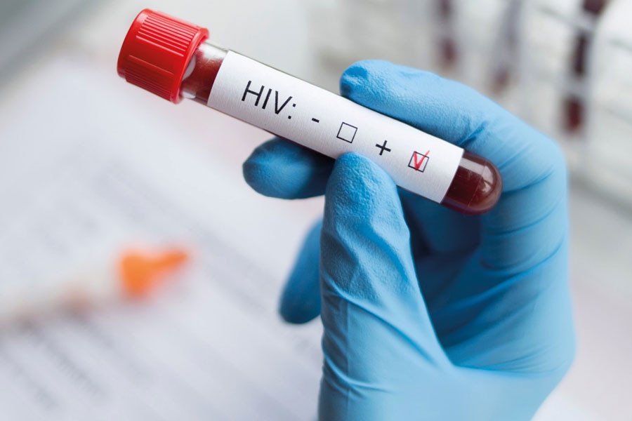Test HIV 4° generazione